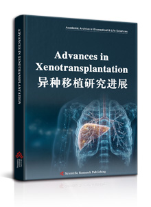 Advances in Xenotransplantation