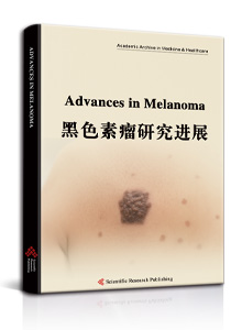 Advances in Melanoma